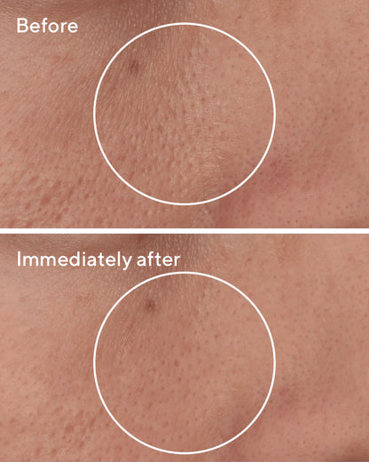 Targeted Pore Corrector