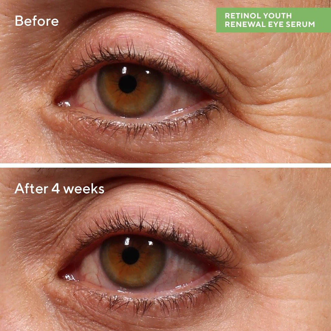 Retinol Youth Renewal Eye Serum