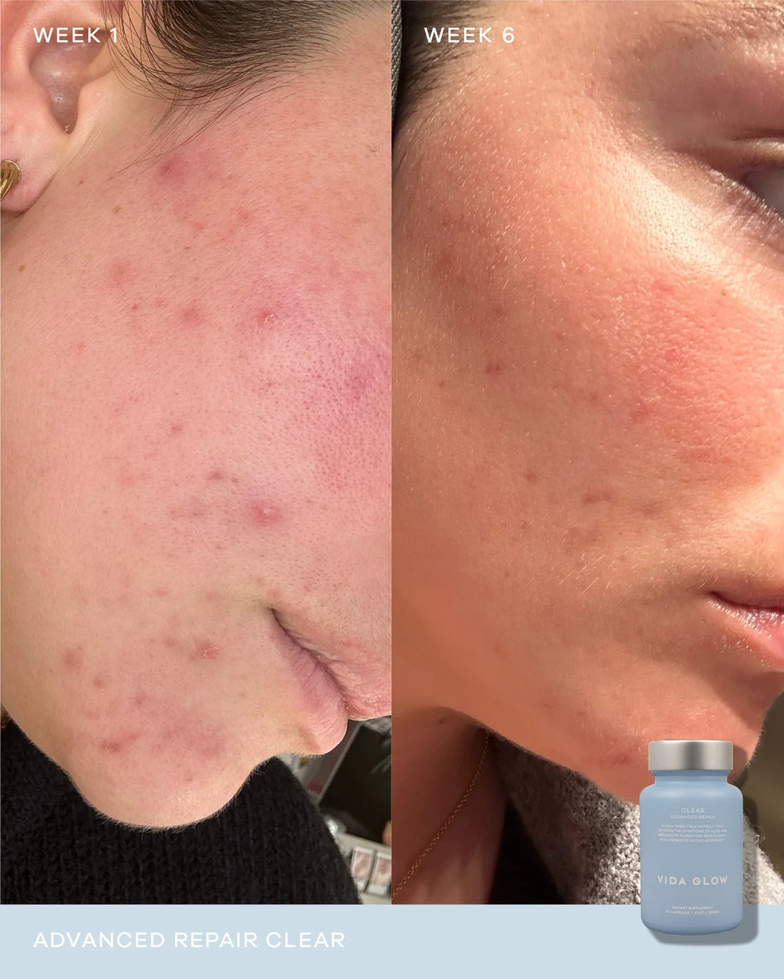 Advanced Repair - Clear