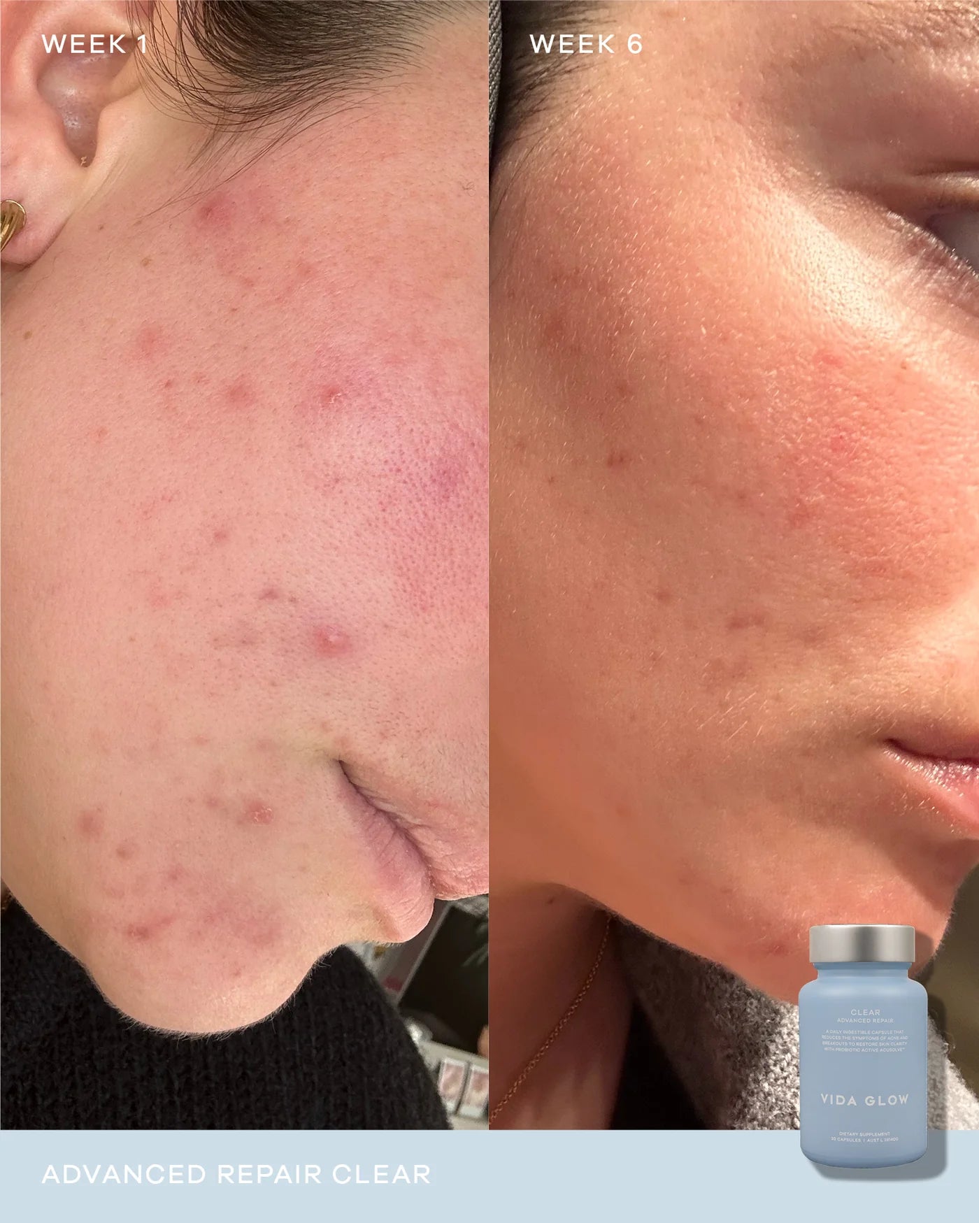 Advanced Repair - Clear